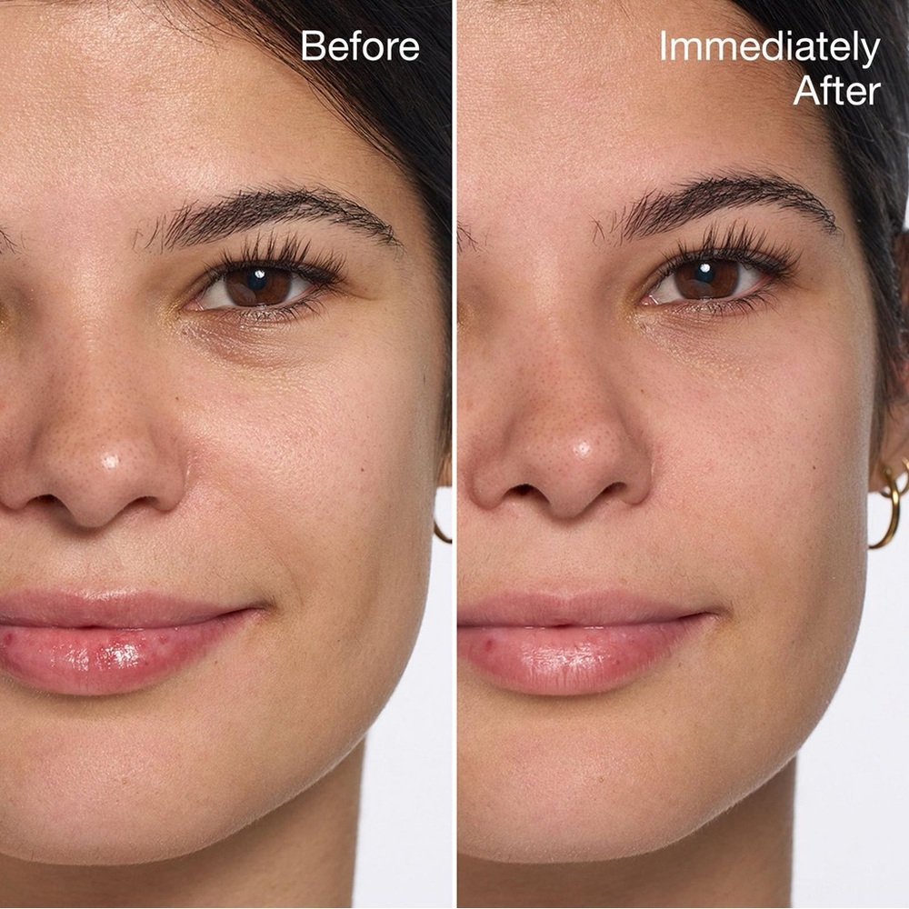 Clinique Moisture Surge 100H Auto Replenishing Hydrator, All About Eyes, & Mask - Picture 9 of 17